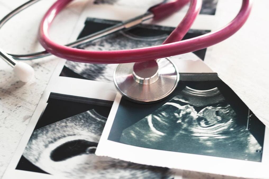 Gallup: 83% of Democrats now support abortion as GOP pro-life identity hits record high
