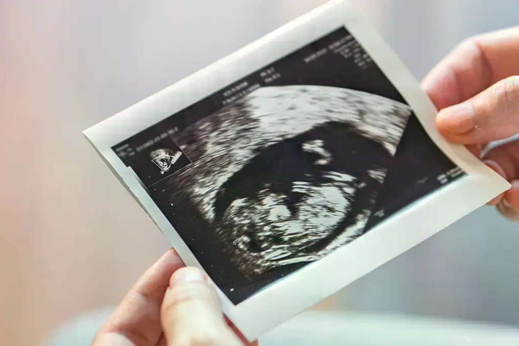 Pro-life orgs fight pro-abortion activists’ internal records demands