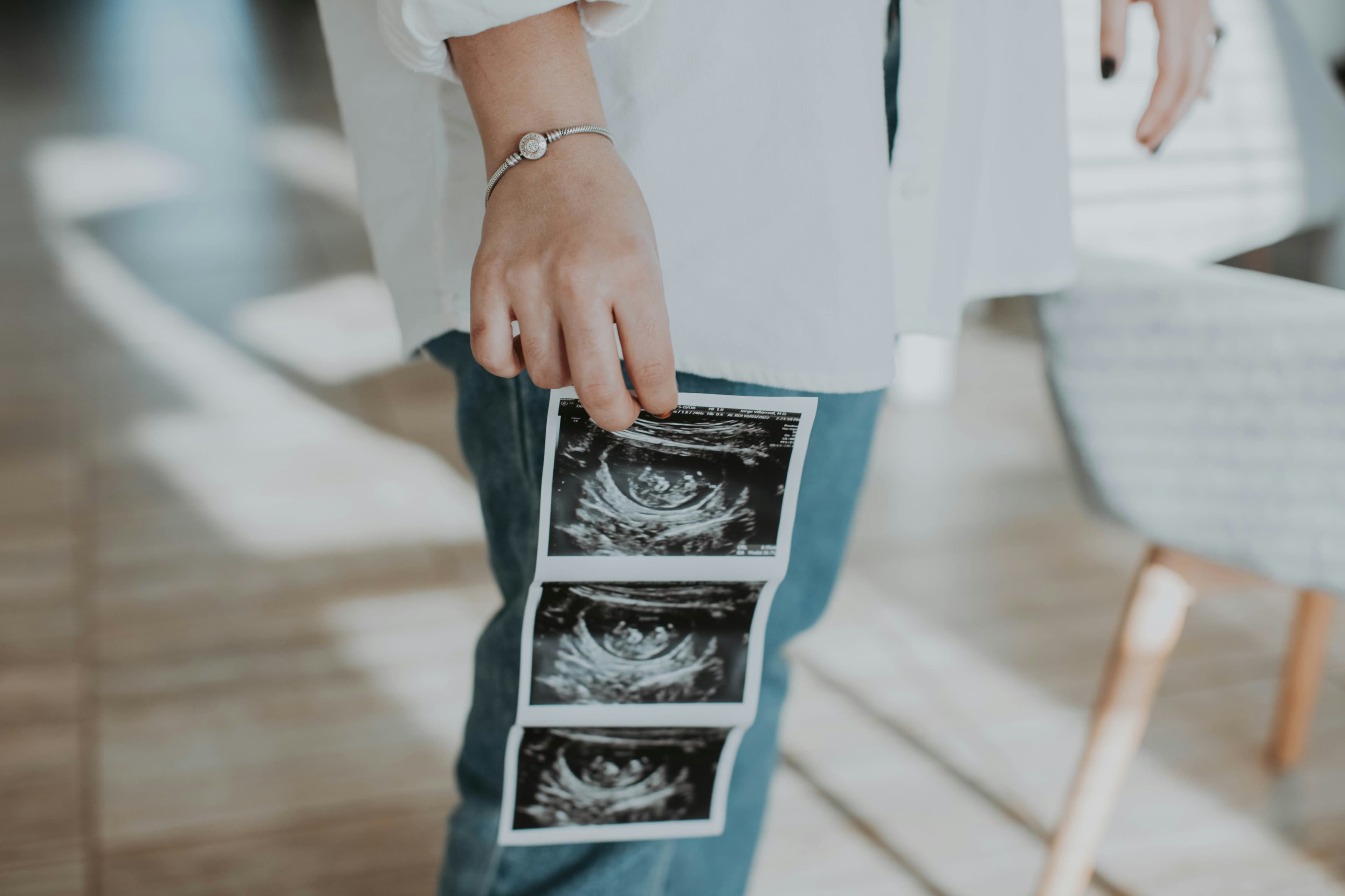 ‘They didn't get the perfect child’: Gay couple sues surrogate who refused to abort son over cleft lip diagnosis